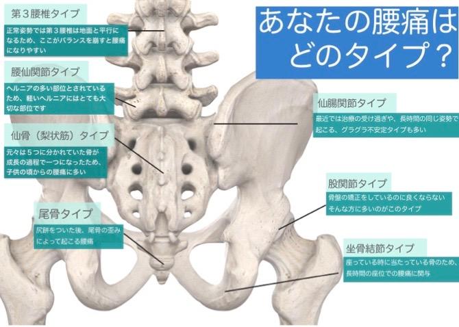 腰痛・腰下肢痛診療のキーポイント 腰痛・腰下肢痛診療のキーポイント