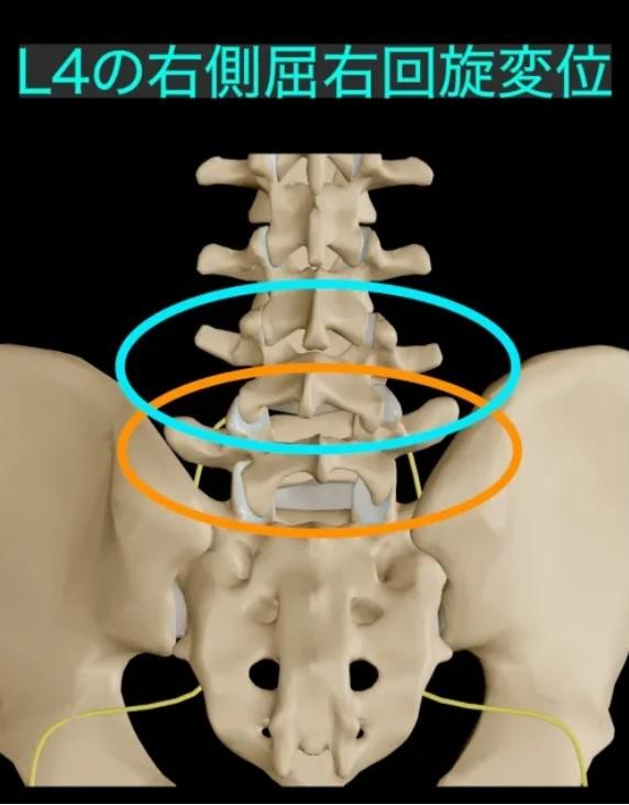 腰痛 神経痛 などに 理学療法士が監修｜「坐骨神経痛」緩和を寝ながら目指す効果的な