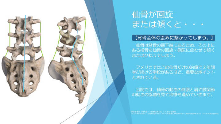坐骨神経痛と仙骨の機能異常 | ブログ | 与野駅より徒歩5分、さいたま新都心・与野本町駅より徒歩12分アギトス鍼灸整骨院