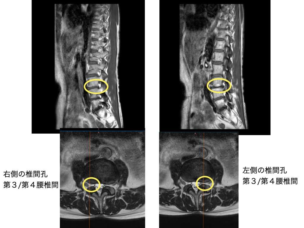 人工股関節全置換術 | あんしん病院