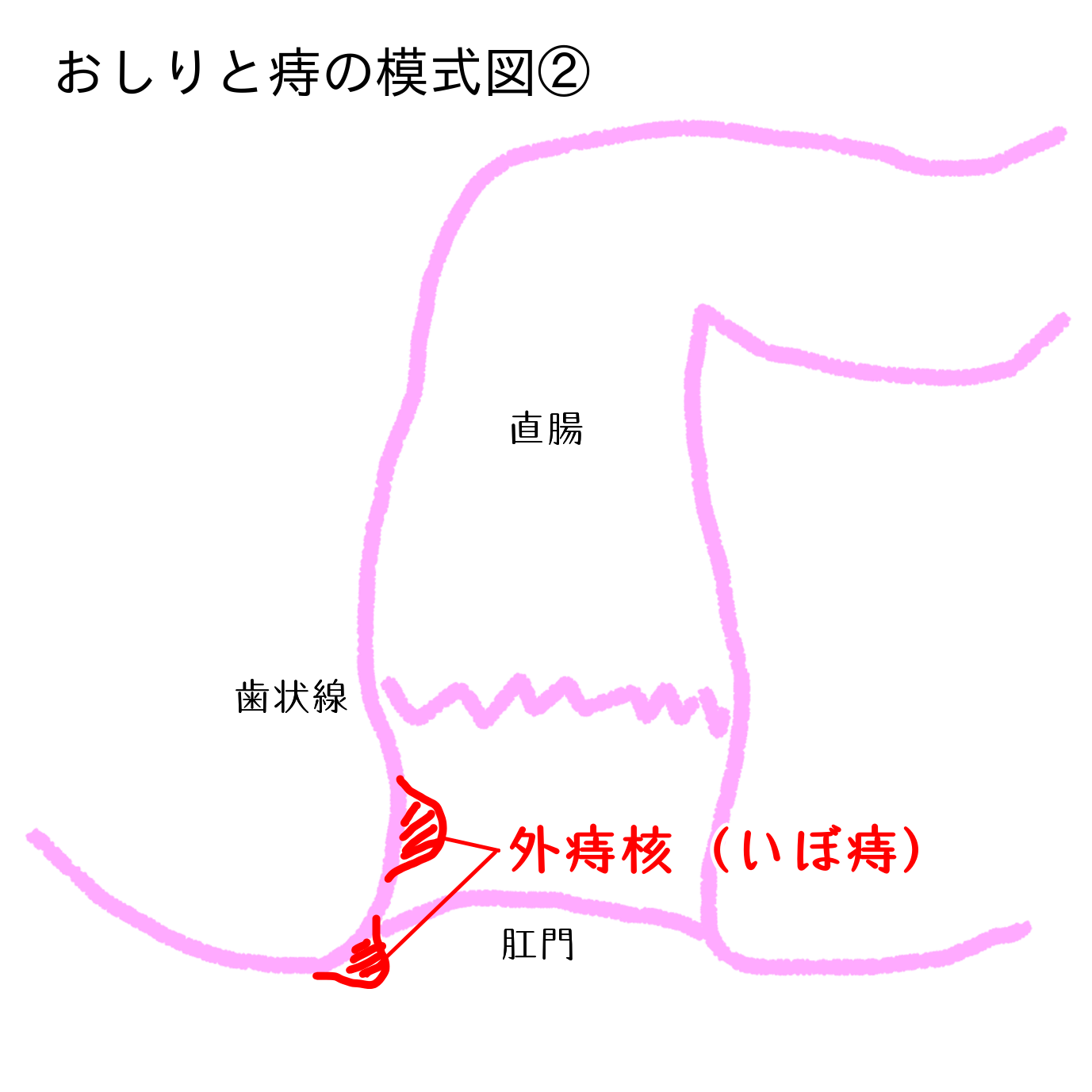 痔と漢方  blog_NEWS  素問元気堂薬局