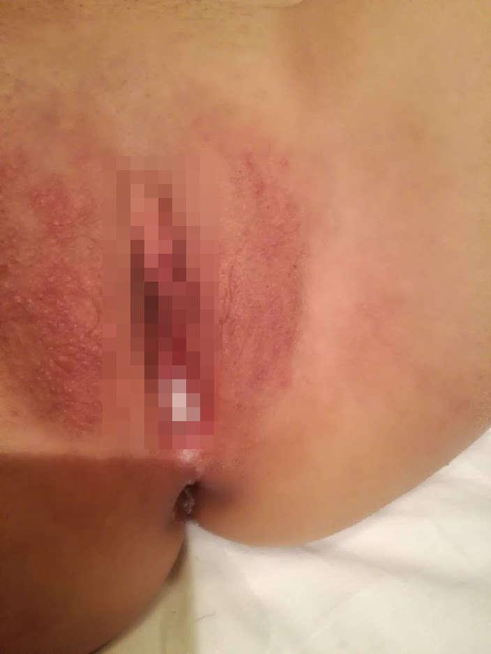 １９歳　結構遠い神奈川からのご来店。彼氏以外とは初めて、セックス２人目。中だし・アフターピル　１９歳