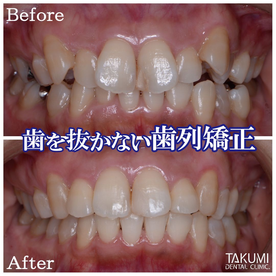 匠歯科 矯正歯科』の答え合わせはまだ先|匠歯科・矯正歯科｜広島市中区