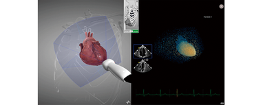 HeartWorks 3Dエコーモジュール』を新発売 | お知らせ | 日本