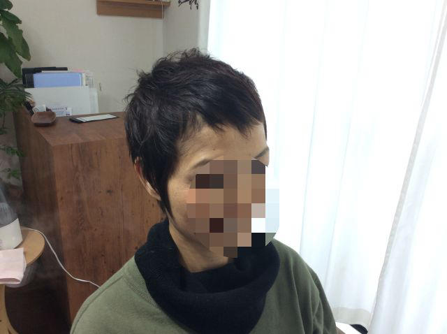 抗がん剤後の自毛をきちんと生やすために Blog Blog フランジパーニ